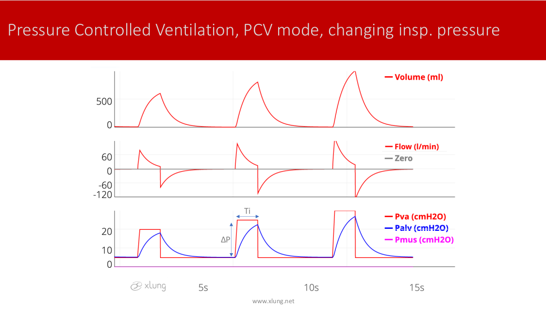 Basic Modes Of Mechanical Ventilation Xlung Net