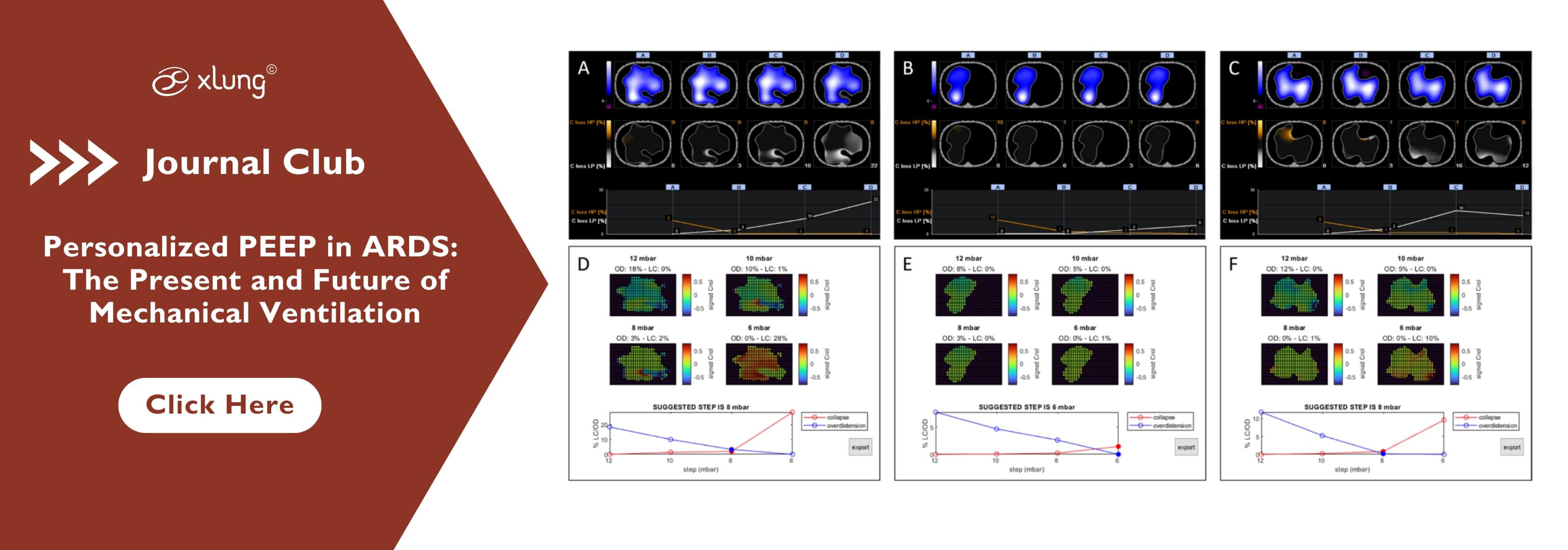 Banner-journal_club-personalized_peep_ards_the_future_of_mv