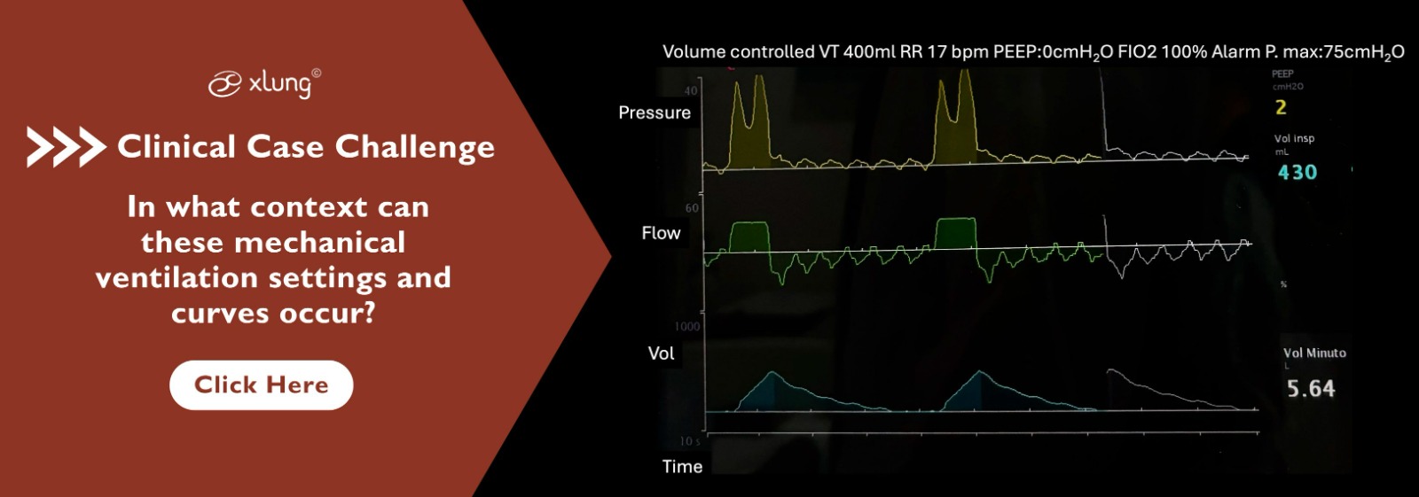 Banner_clinical-case-challenge_-_in-what-context-mechanical-ventilation-curves-occur