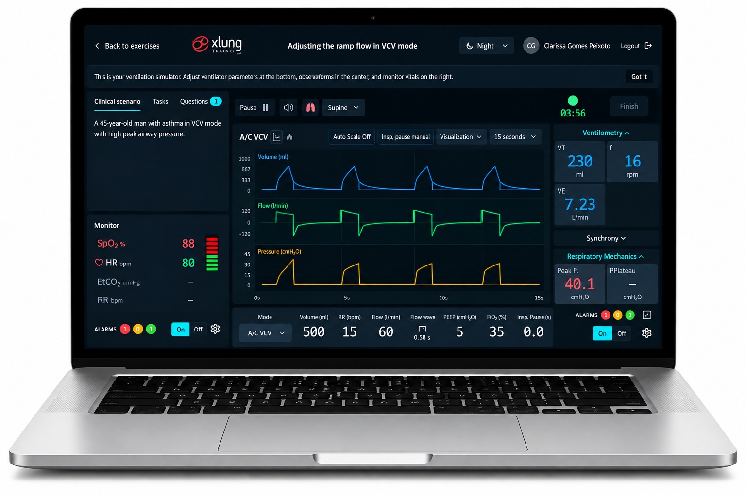 <p><strong>03. Put your decisions into practice: solve the exercise</strong></p> <p>Adjust the ventilation parameters and solve the challenge in a more realistic interface, inspired by real mechanical ventilators.</p>
