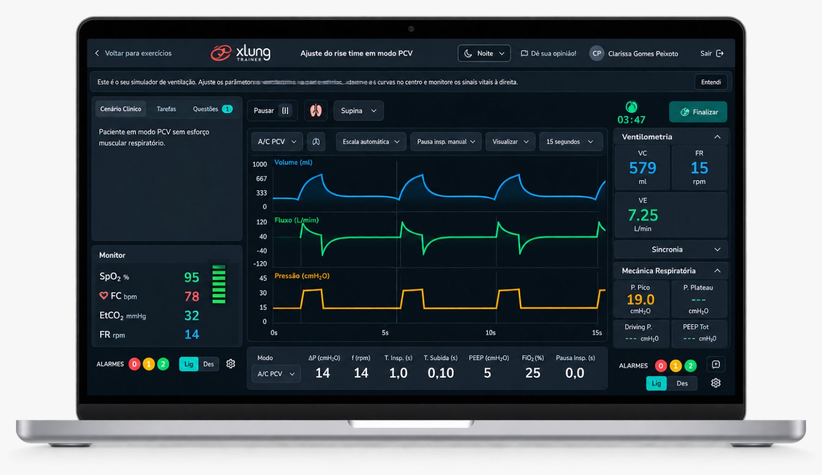 <p><strong>03. Coloque suas decisões em prática: resolva o exercício</strong></p> <p>Ajuste os parâmetros ventilatórios e resolva o desafio em uma interface mais realista e inspirada em ventiladores mecânicos reais.</p>