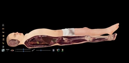 Virtual Dissection Table Virtual Dissection Table