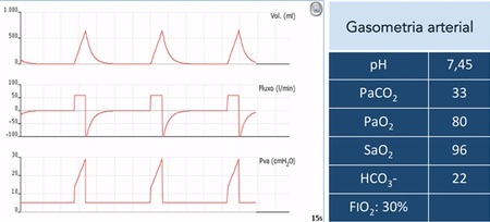 Imagem 2 Quiz 6 (2) Imagem 2 Quiz 6 (2)