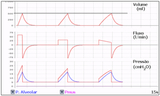 Ciclos respiratórios mecânicos do tipo CONTROLADO e CICLADO A VOLUME (VCV) Ciclos respiratórios mecânicos do tipo CONTROLADO e CICLADO A VOLUME (VCV)