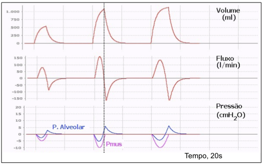 Ciclos respiratórios fisiológicos Ciclos respiratórios fisiológicos