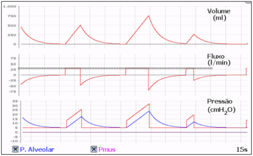 Ciclos respiratórios mecânicos do tipo CONTROLADO e CICLADO A VOLUME (VCV) Ciclos respiratórios mecânicos do tipo CONTROLADO e CICLADO A VOLUME (VCV)