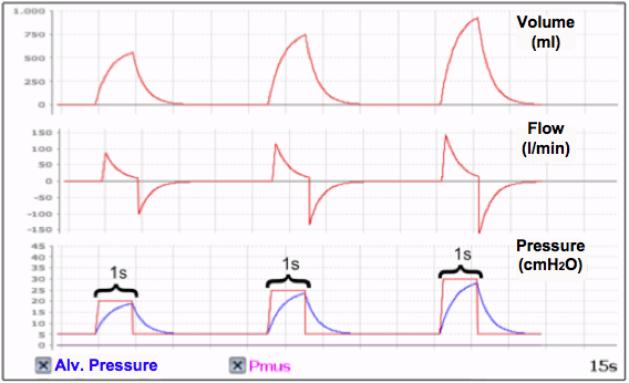 CONTROLLED and TIME CYCLES WITH CONSTANT PRESSURE (PCV) mechanical respiratory cycles. - 2