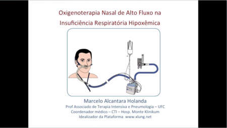 Oxigenoterapia de Alto Fluxo Nasal na Insuficiência Respiratória Aguda Parte 1A: Como funciona