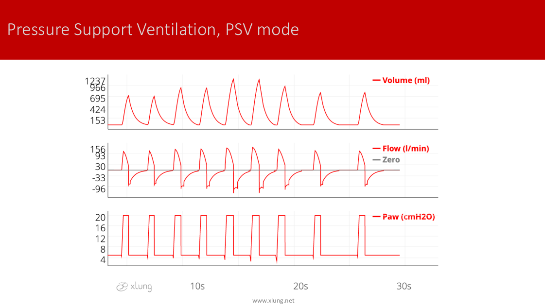 ventilator graphics made easy