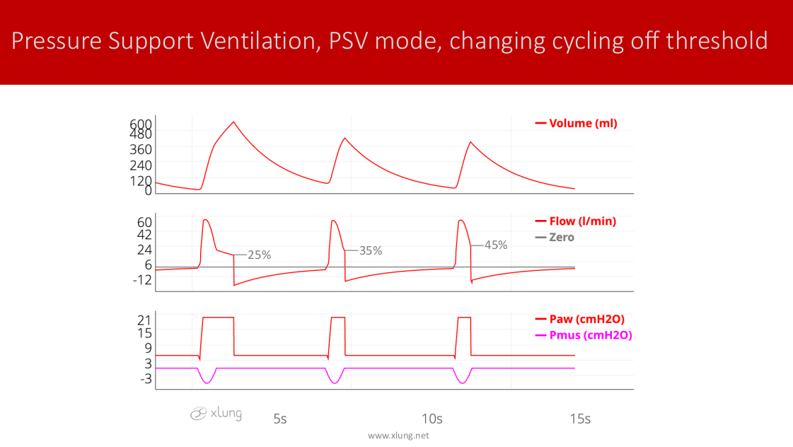 Mechanical Ventilation Manual - Basic Modes of Mechanical Ventilation ...