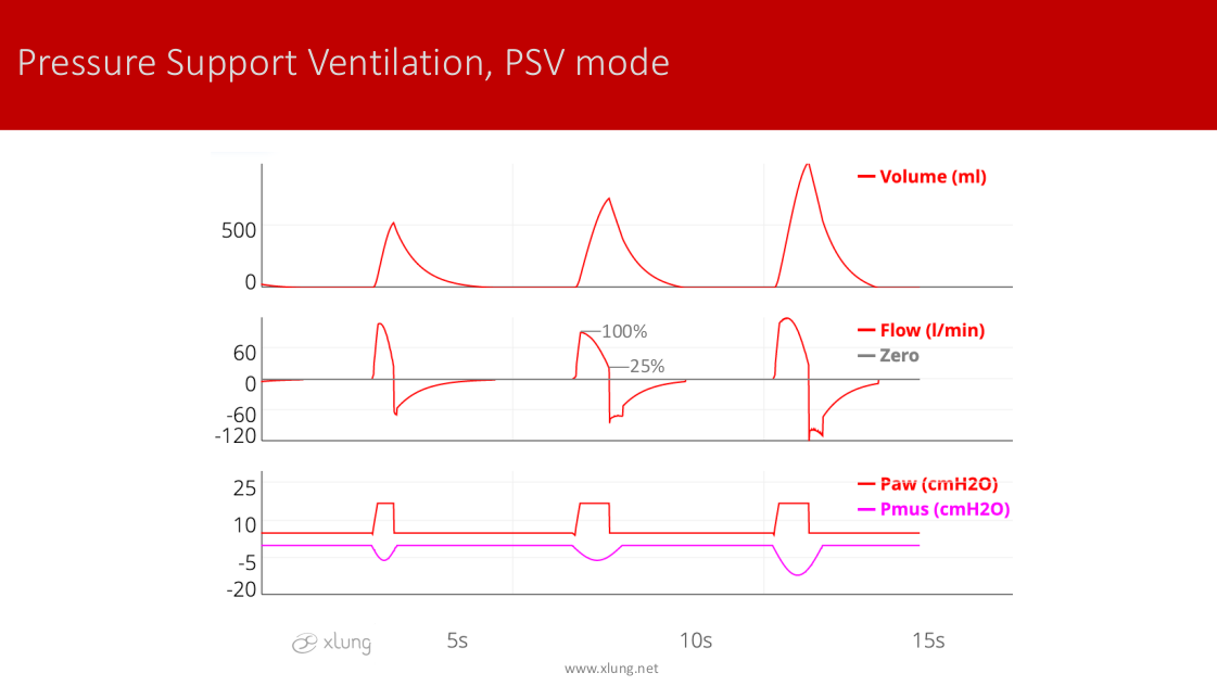 Mechanical Ventilation Manual - Basic Modes of Mechanical Ventilation ...