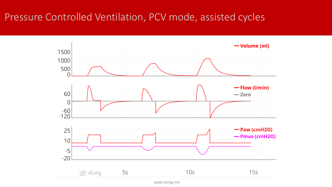 Mechanical Ventilation Manual - Basic Modes of Mechanical Ventilation ...