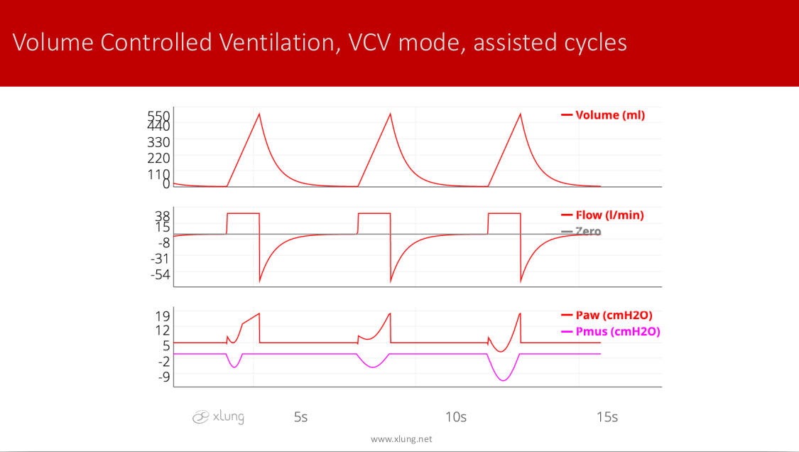 Mechanical Ventilation Manual - Basic Modes of Mechanical Ventilation ...