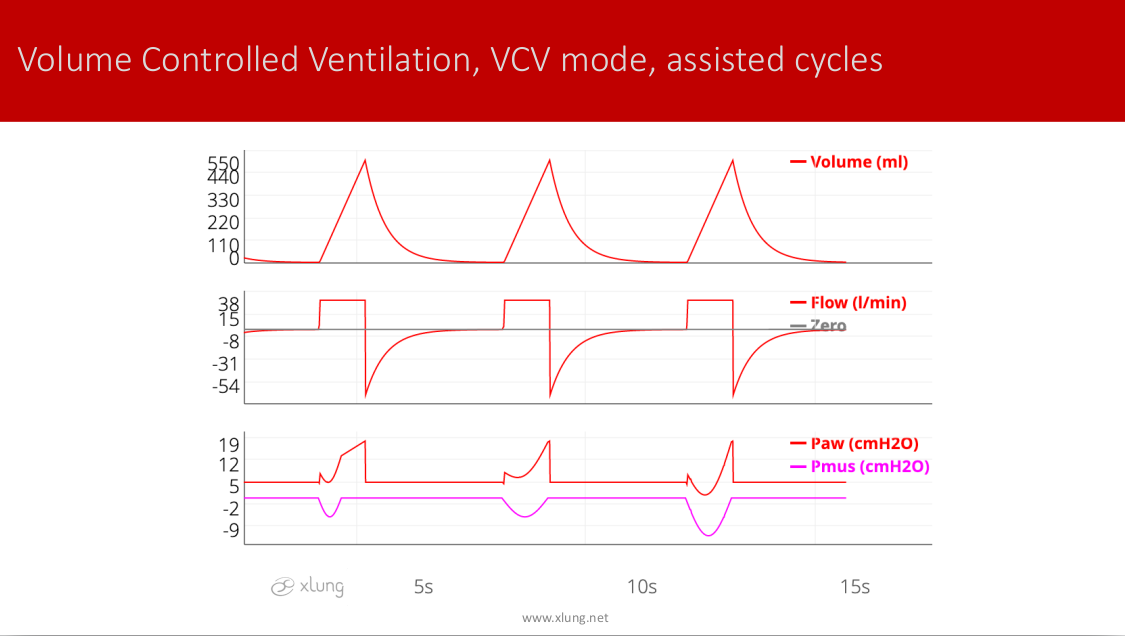 Basic Modes of Mechanical Ventilation