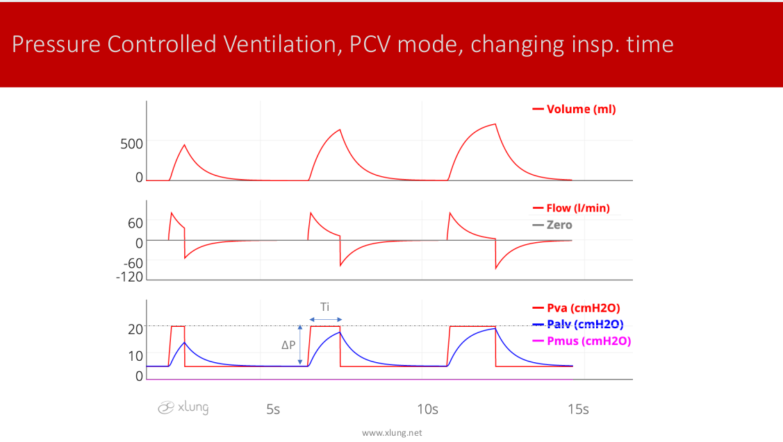 Mechanical Ventilation Manual - Basic Modes of Mechanical Ventilation ...