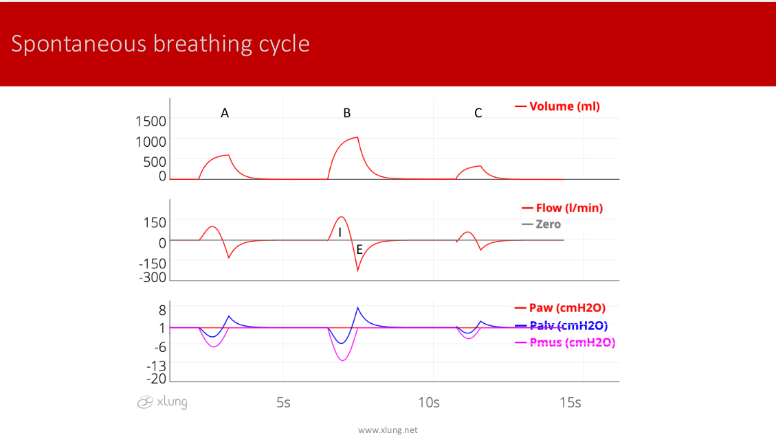 Basic Modes Of Mechanical Ventilation